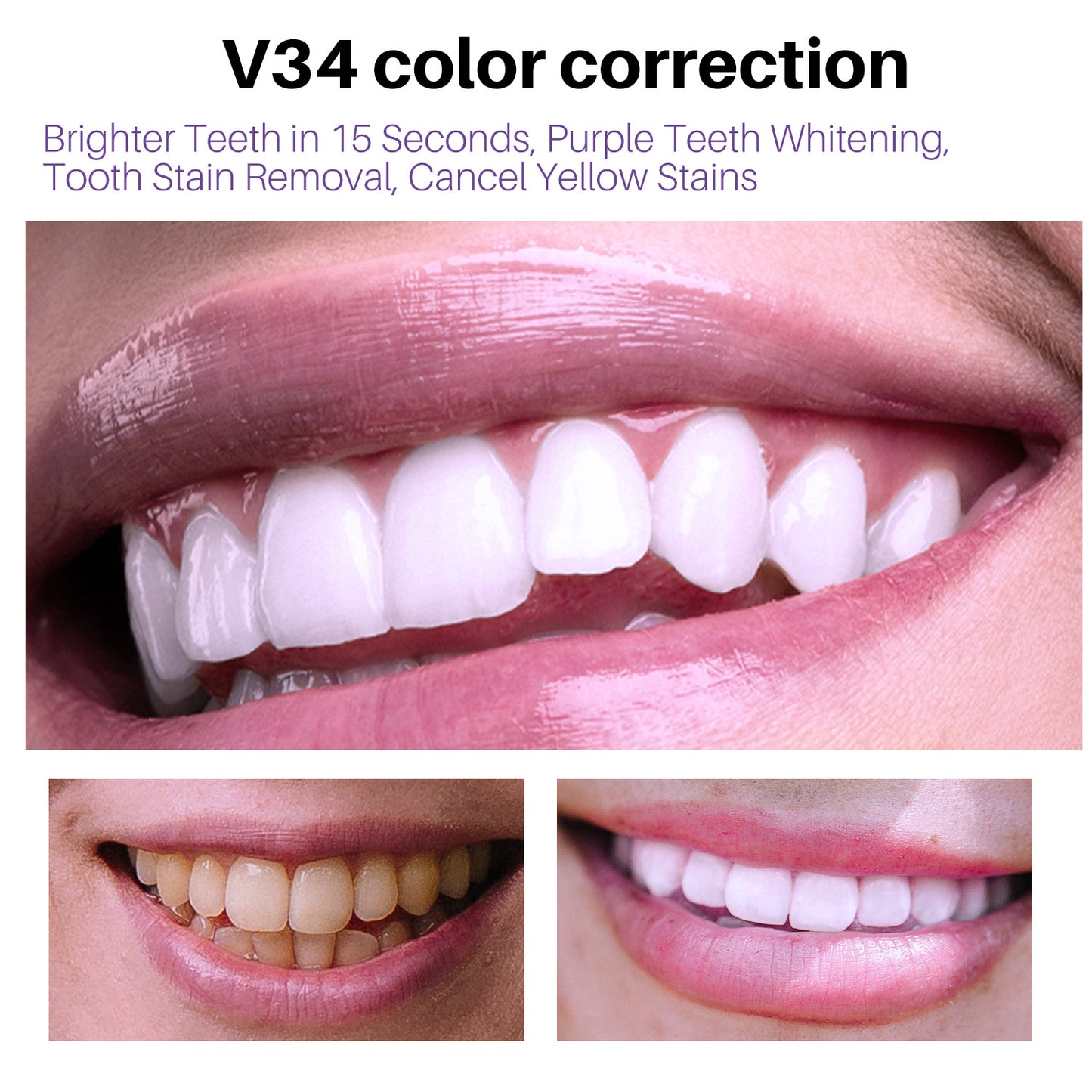 Lanthome V34 dental mousse for oral care