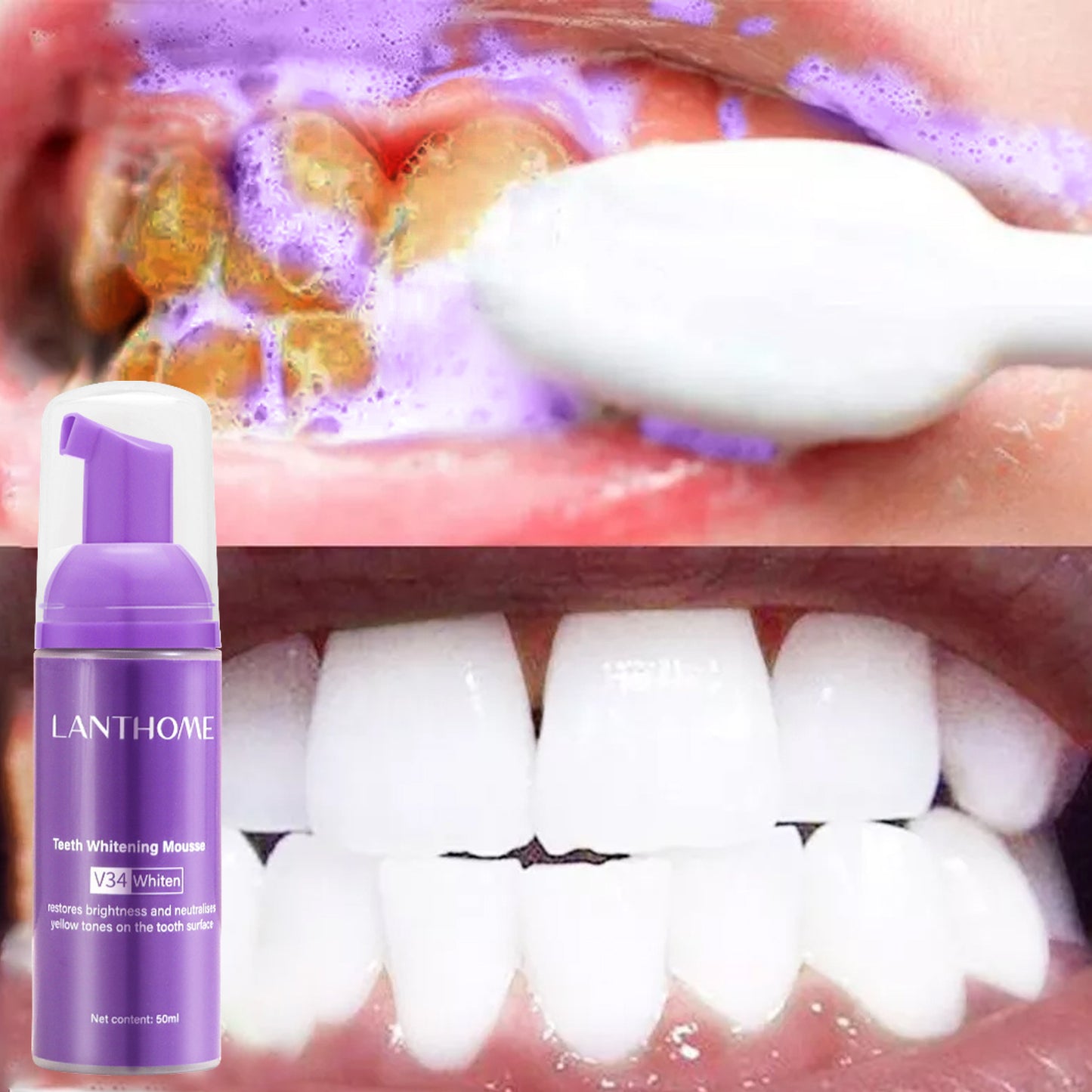 Lanthome V34 dental mousse for oral care