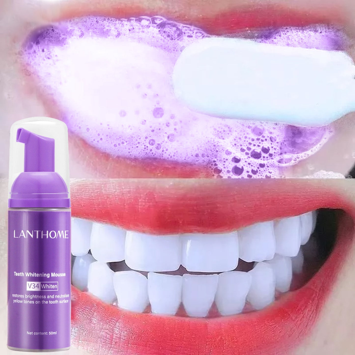 Lanthome V34 dental mousse for oral care